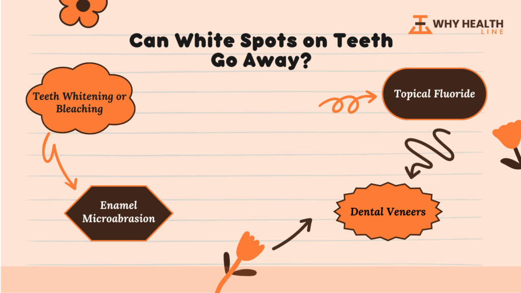 White Spots On Teeth Treatments And Preventions