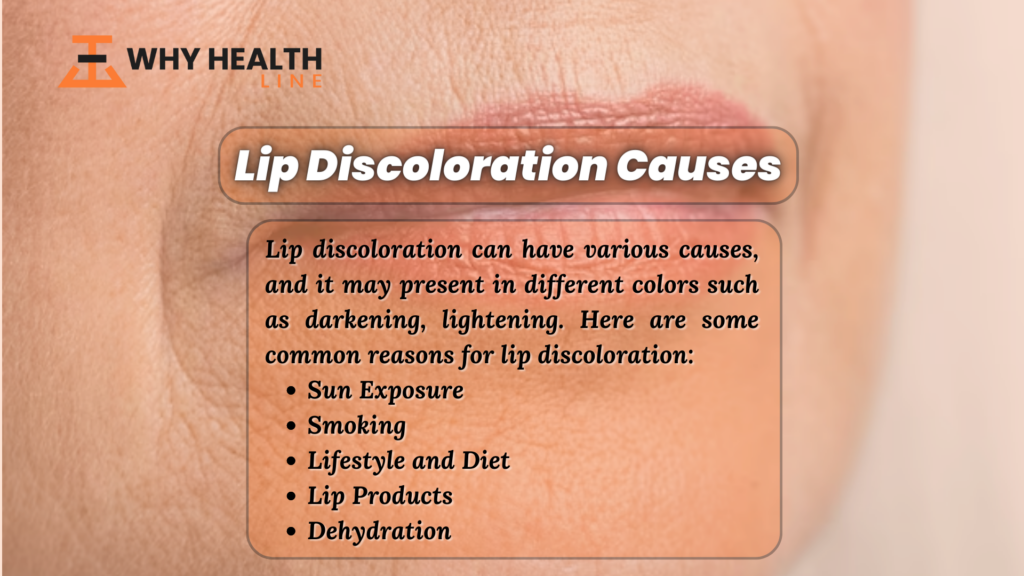 Lip Discoloration What It Means Causes And Treatments 1381