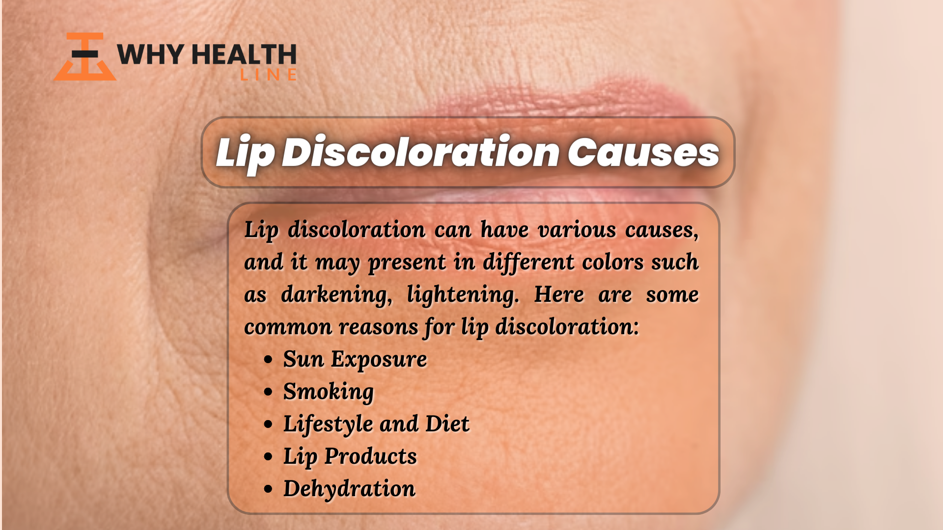 Lip Discoloration Causes