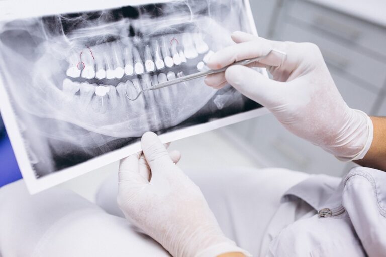 dental implant surgery