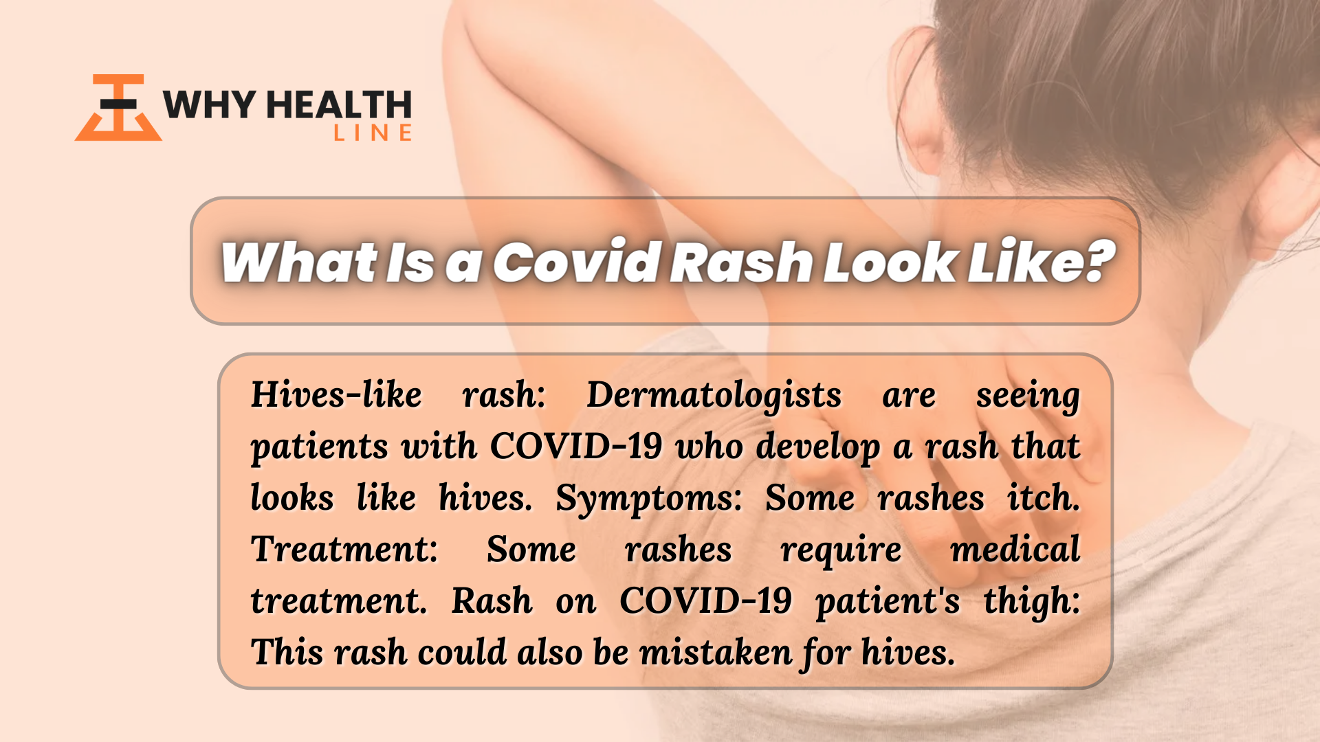 What Is a Covid Rash Look Like?