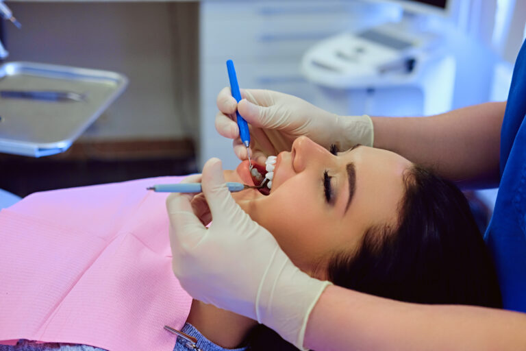 Why Composite Fillings Are The Best Dentist Choice?