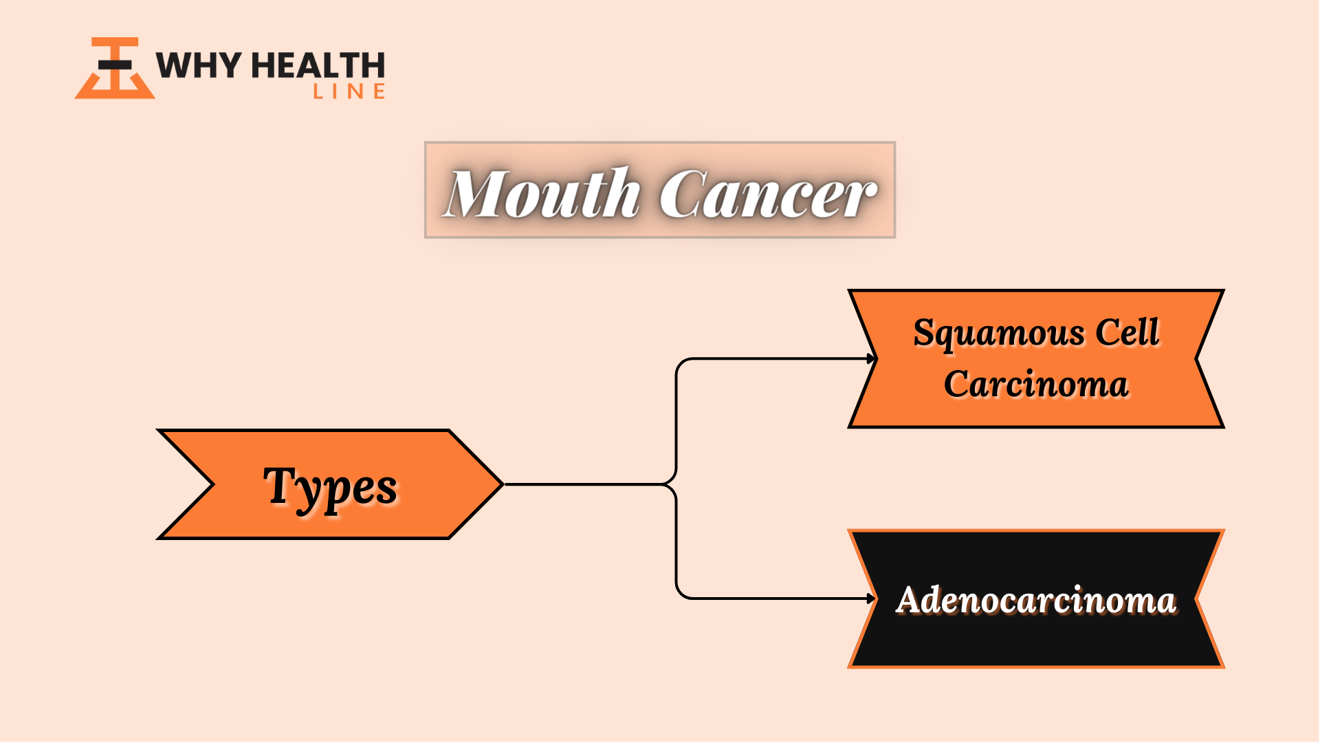 Types of Mouth Cancer
