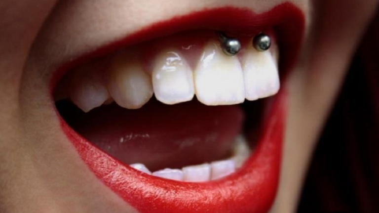 smiley piercings