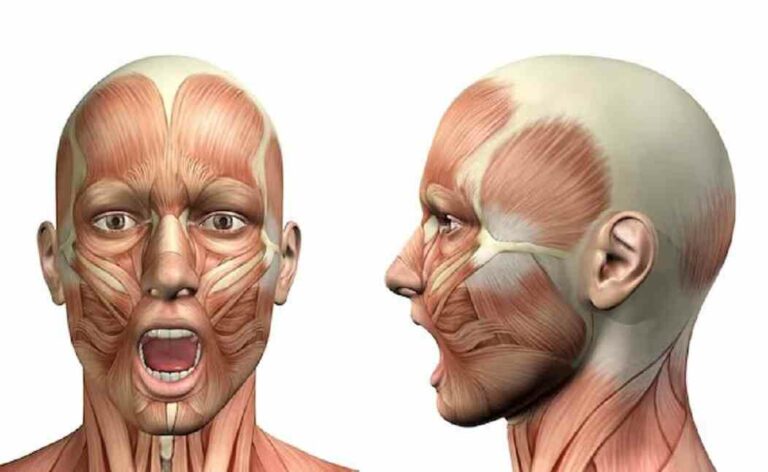 Aneurysm Vs Stroke