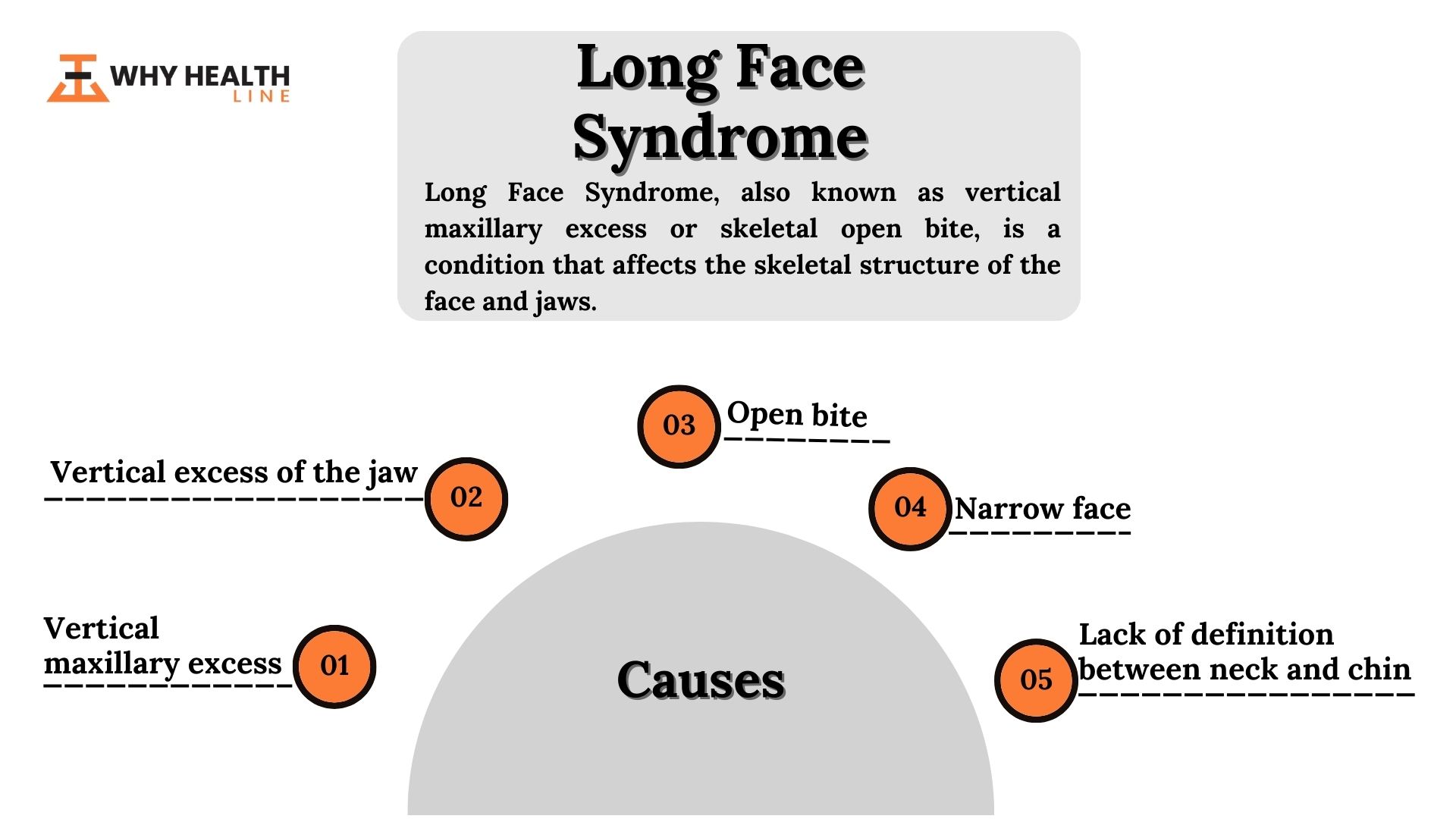 Long Face Syndrome