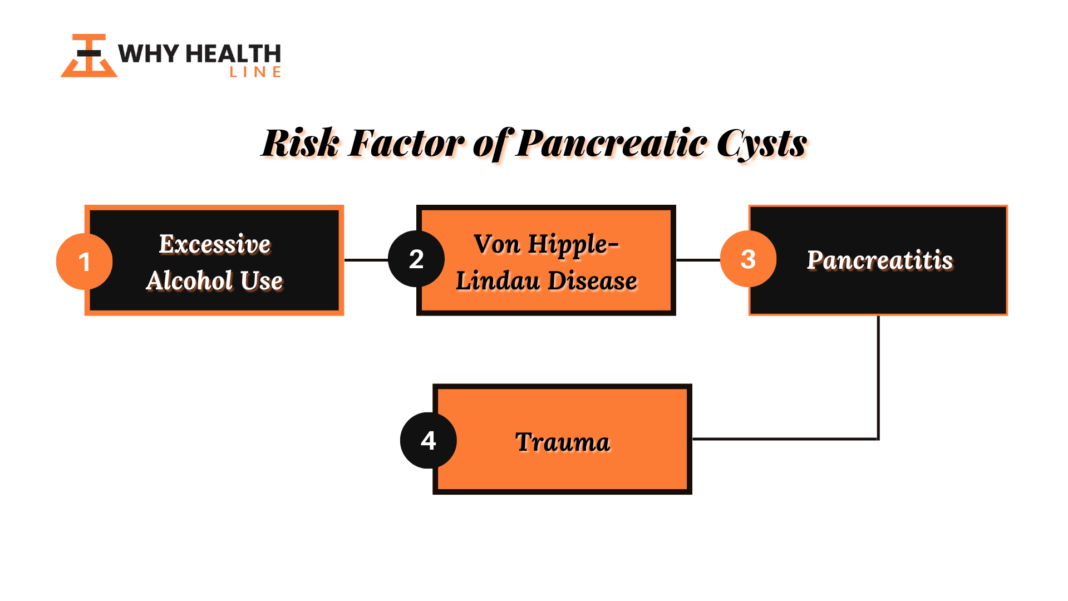 Pancreatic Cysts: Symptoms, Types and Its Risk Factors