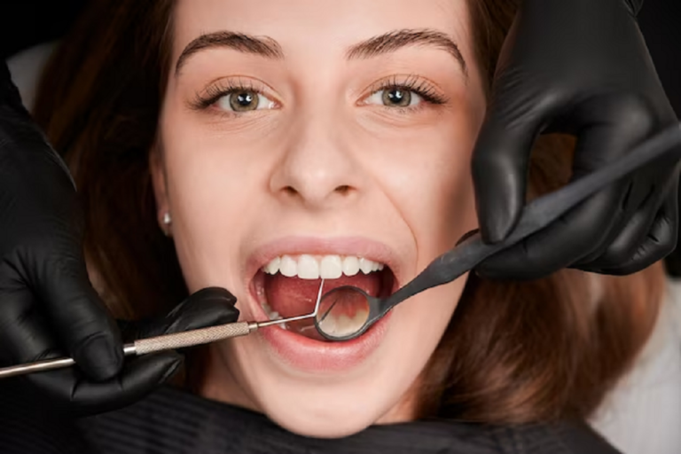 Black Lines on Teeth: How To Get Rid Of Them?